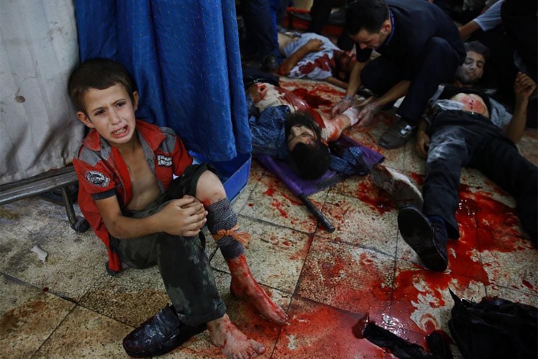 2015年8月12日，一个受伤的叙利亚男孩坐在地上接受治疗。