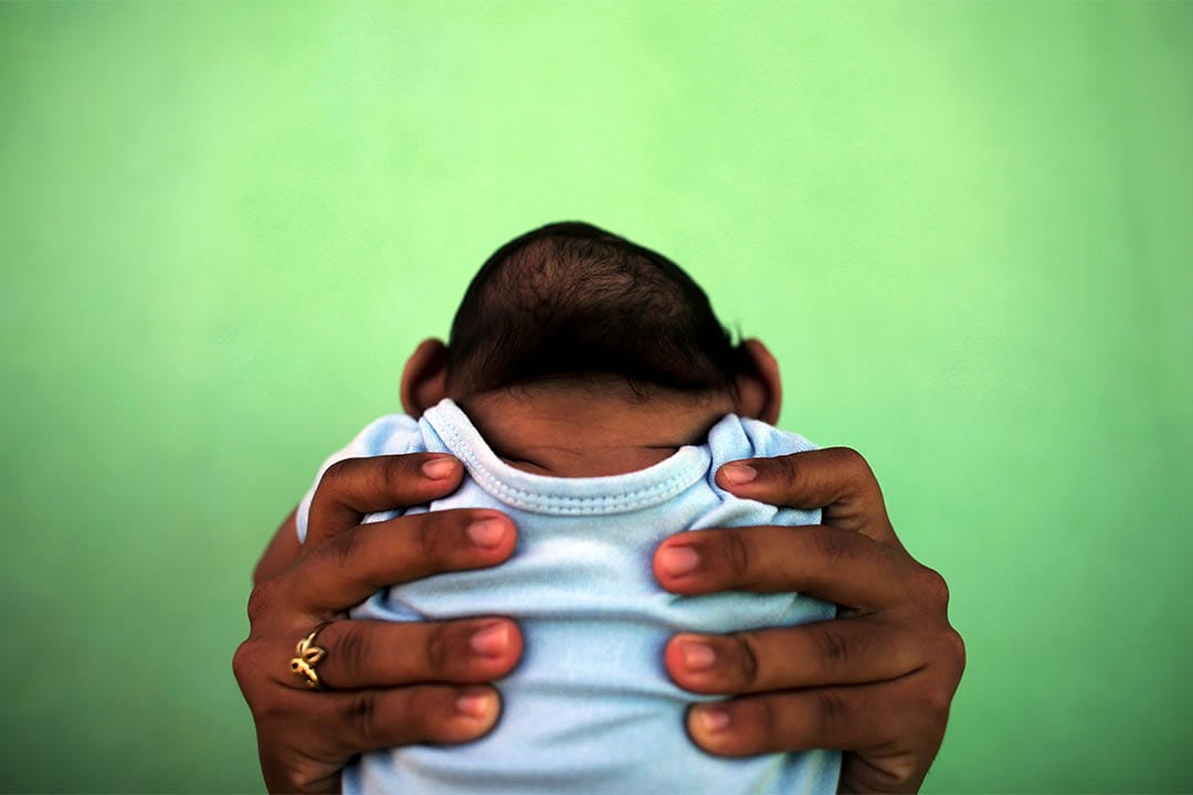 2016年2月11日,巴西,一个母亲抱起患有小头症的孩子。