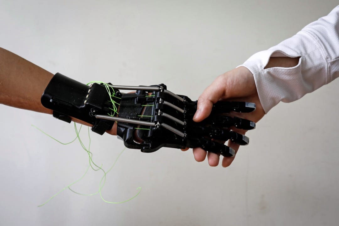 戴上义肢的Angel牵著妈妈的手。