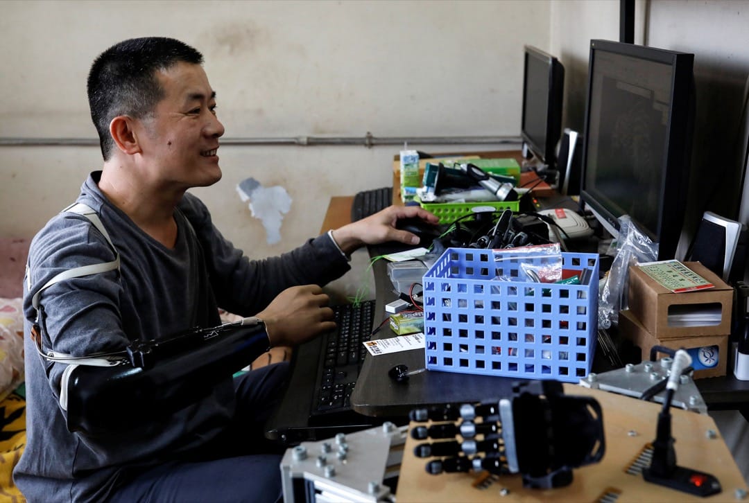 张宪良用电脑设计义肢。