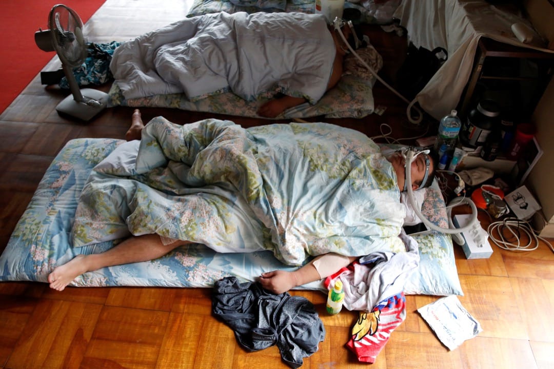 相撲手睡覺時需要戴上氧氣罩協助呼吸,以確保呼吸暢順。