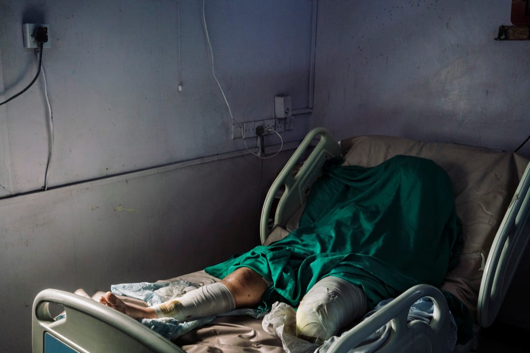 2018年12月13日，也门港口城市荷台达，25岁的Wafa Ahmed Hathim躺在医院里，她在一次迫击砲袭击中失去了左脚。