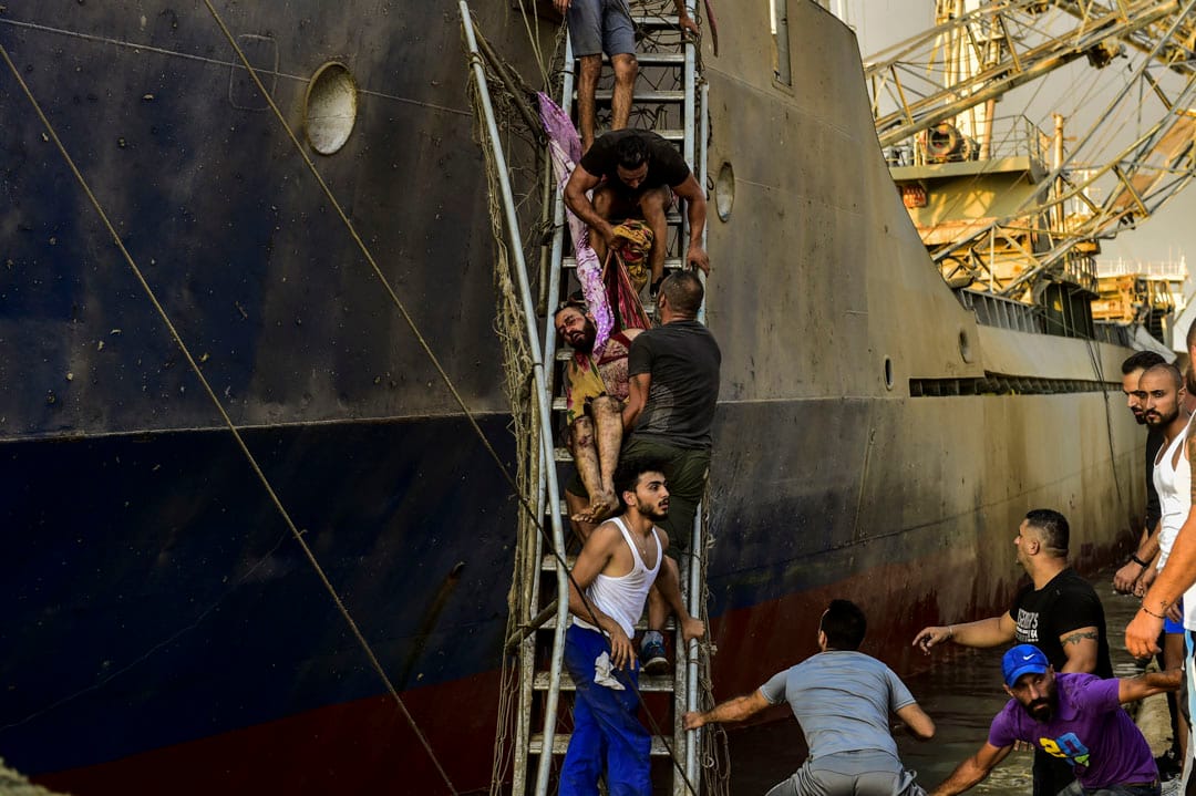 一名在爆炸中受傷的傷者被抬離現場。