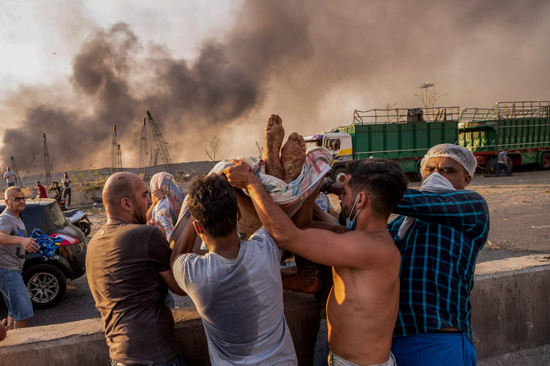 一名在爆炸中受傷的傷者被抬離現場。